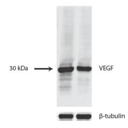 Anti - VEGFA Mouse mAb