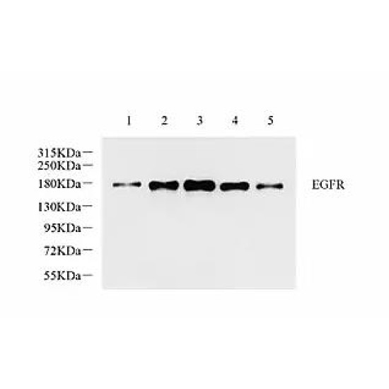 Anti - EGFR Rabbit pAb