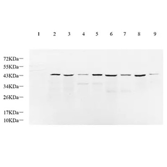 Anti - IL-2 Receptor alpha Rabbit pAb