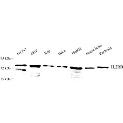 Anti - IL2 Receptor beta/p75 Rabbit pAb