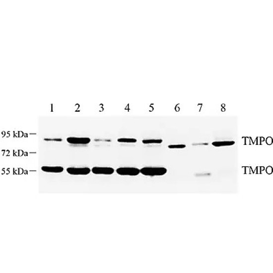 Anti - LAP2 Rabbit pAb