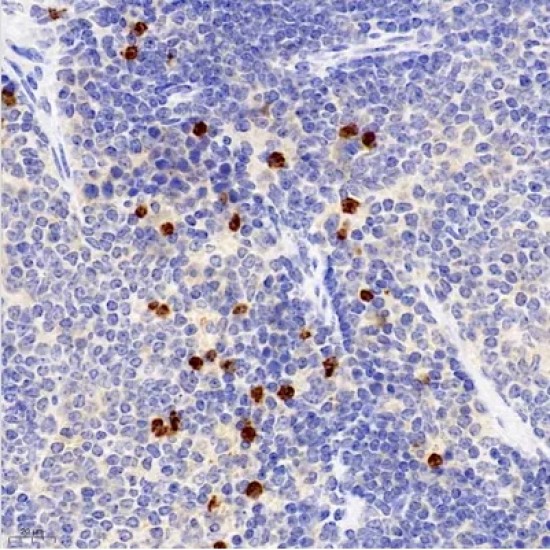 Anti - Macrophage Inflammatory Protein 1 alpha/CCL3 Rabbit pAb