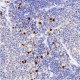 Anti - Macrophage Inflammatory Protein 1 alpha/CCL3 Rabbit pAb