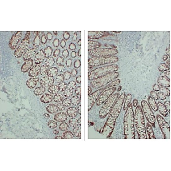 Anti - TGF beta Receptor I Mouse mAb