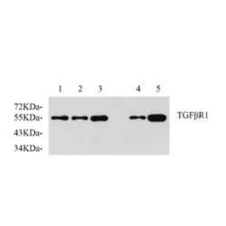 Anti - TGF beta Receptor I Rabbit pAb