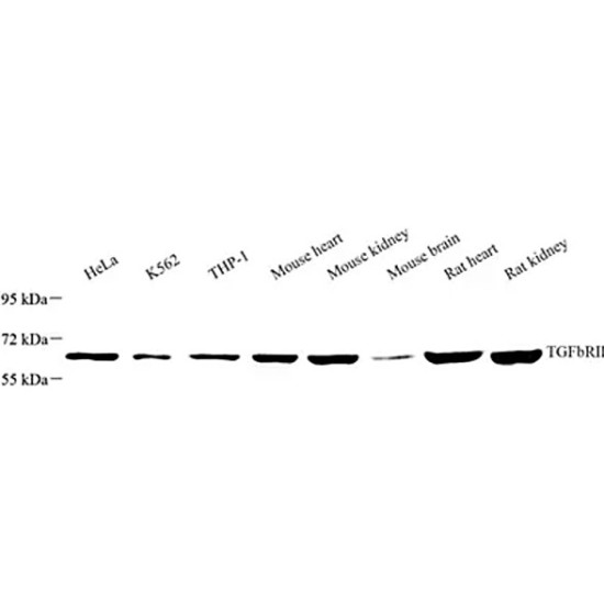 Anti - TGF beta Receptor II Rabbit pAb