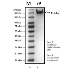 Recombinant SARS-CoV-2 Spike protein, Beta  B.1.351 South African variant