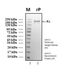 Recombinant SARS-CoV-2 Spike protein, Brazilian P.1. variant