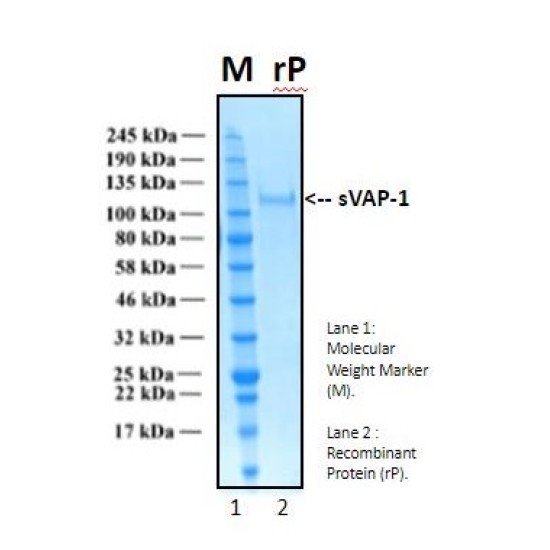 Recombinant Human Soluble Vascular Adhesion Protein-1, sVAP-1