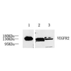 Anti - VEGF Receptor 2 Rabbit pAb