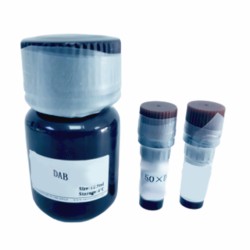 Immunohistochemistry Kit (Anti - Rabbit)
