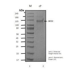 Recombinant Human Angiotensin - Converting Enzyme 2, ACE2