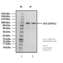 Recombinant Human Autotaxin, ATX (ENPP2)