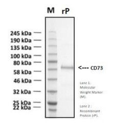 Recombinant Human Ecto - 5' - Nucleotidase (5' - NT)/CD73