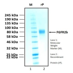 Recombinant Human Fibroblast Growth Factor Receptor 2, FGFR2b