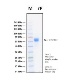 Recombinant Human Fibroblast Growth Factor Receptor 3, FGFR3c