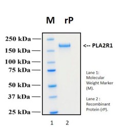 Recombinant Human Secretory Phospholipase A2 Receptor 1, PLA2R1