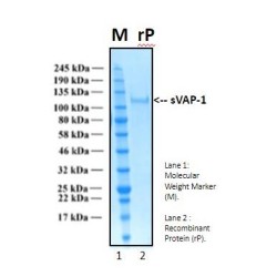 Recombinant Human Soluble Vascular Adhesion Protein-1, sVAP-1